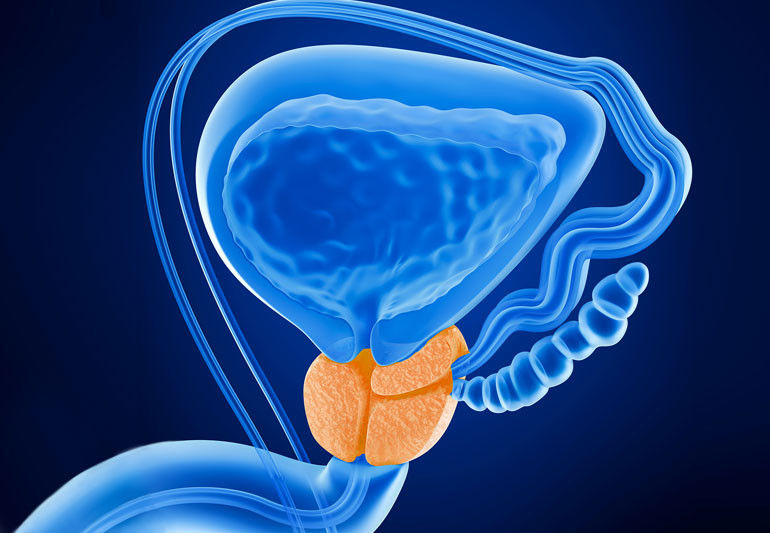 Molecular diagnostics and targeted treatment of prostate cancer