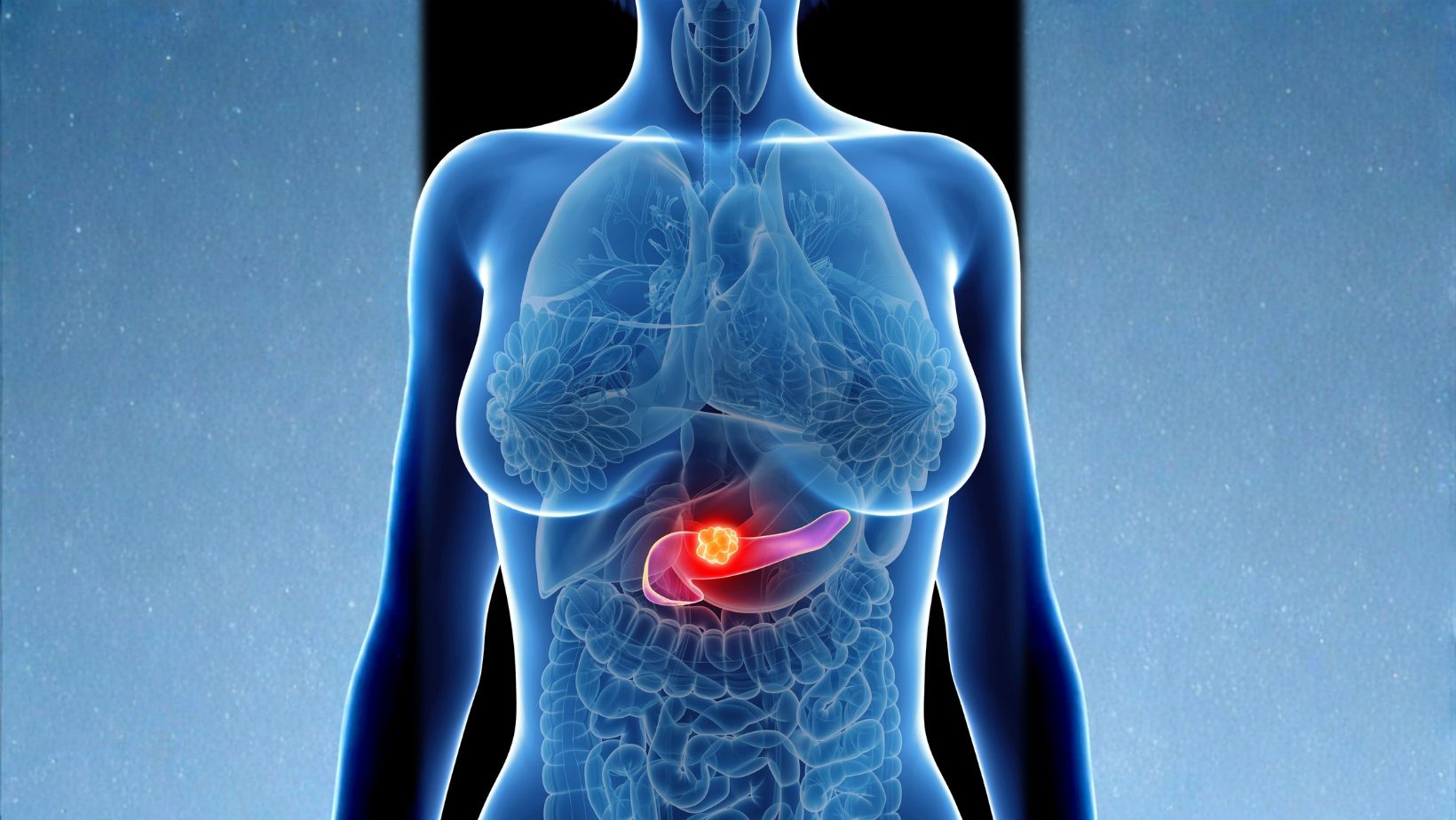 Hasnyálmirigyrák tünetei: miért fontos a gyors felismerés? A hasnyálmirigyrák tünetek sajnos csak későn jönnek elő
