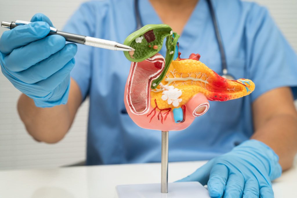 Az epeúti daganat kezelése és tünetei