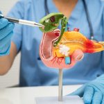 Az epeúti daganat kezelése és tünetei