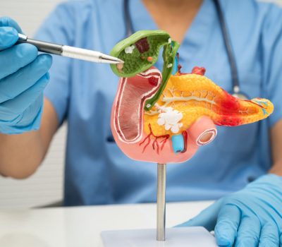 Epeúti daganatok kezelése és tünetei