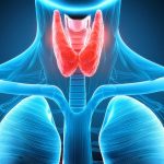 A pajzsmirigyrák kezelése és tünetei