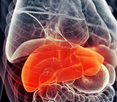 Májrák: a hepatitisz fertőzéstől a daganatig – tünetek és rizikófaktorok